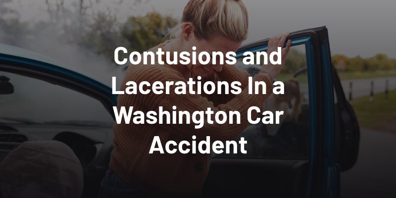 Contusions and Lacerations In a Washington Car Accident