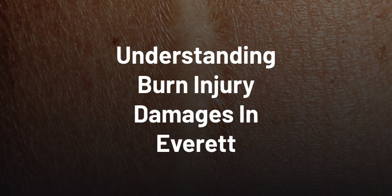 Understanding Burn Injury Damages In Everett