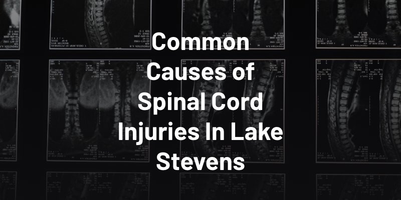 Common Causes of Spinal Cord Injuries In Lake Stevens