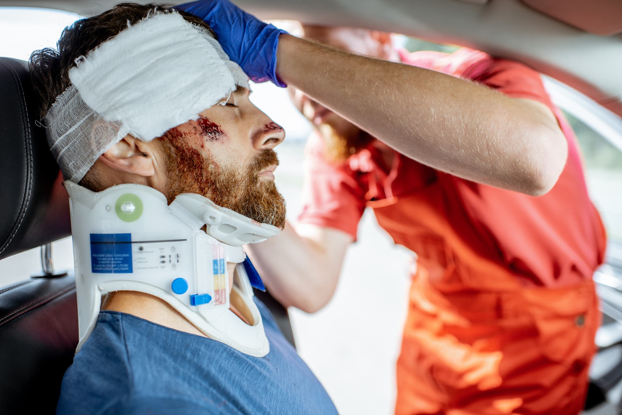 head injury in car